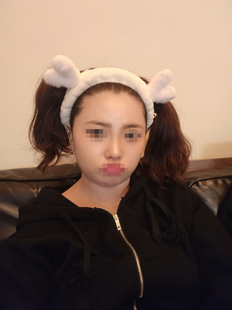 수술후기이미지