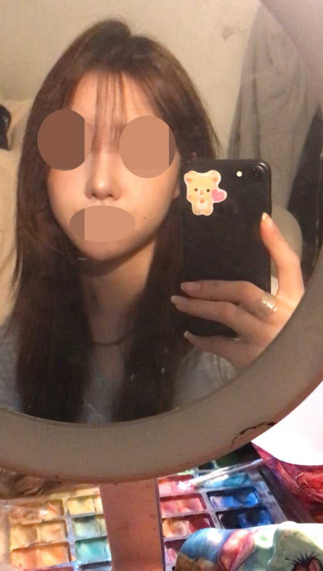 수술후기이미지