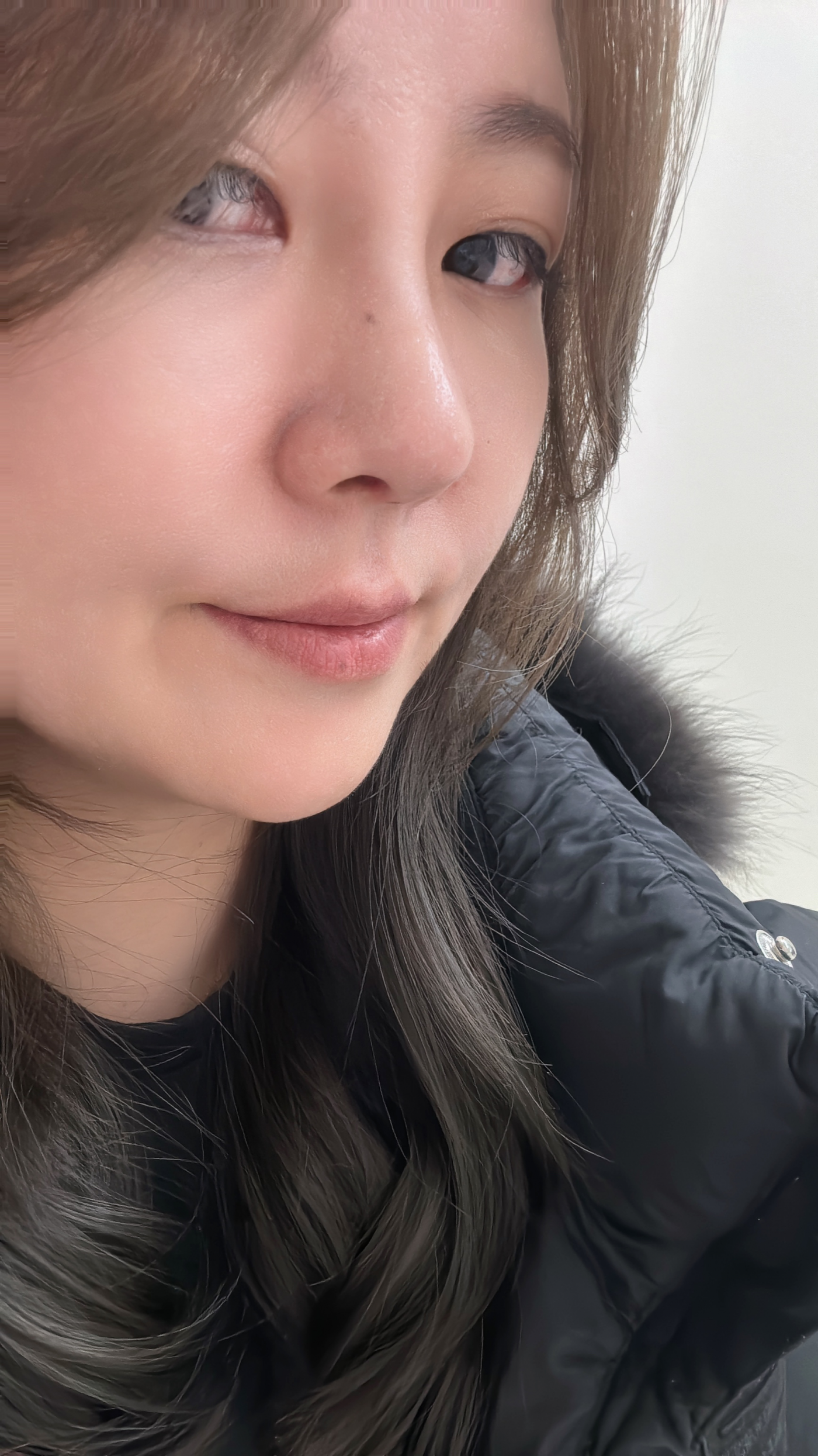 수술후기이미지