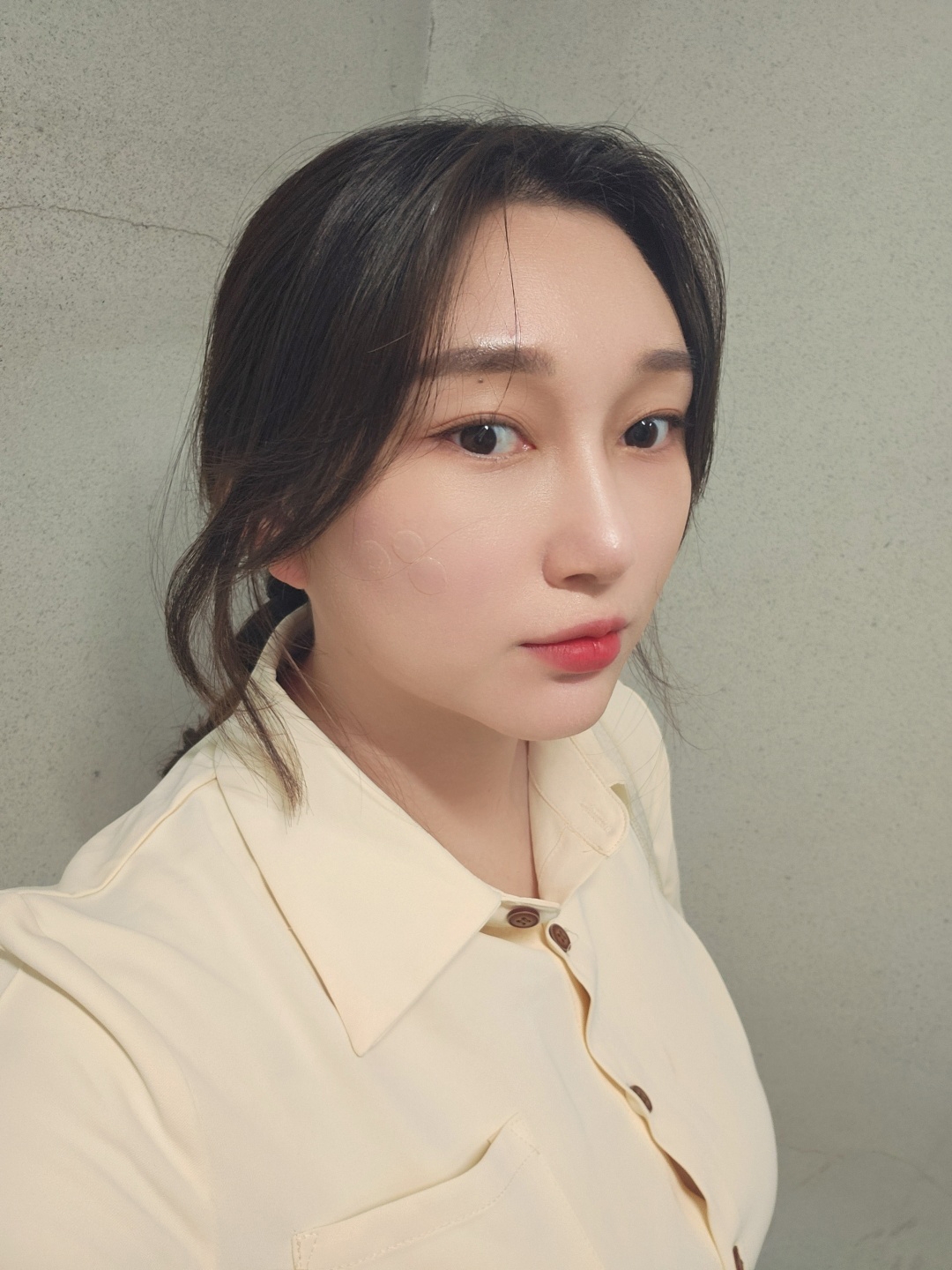 수술후기이미지