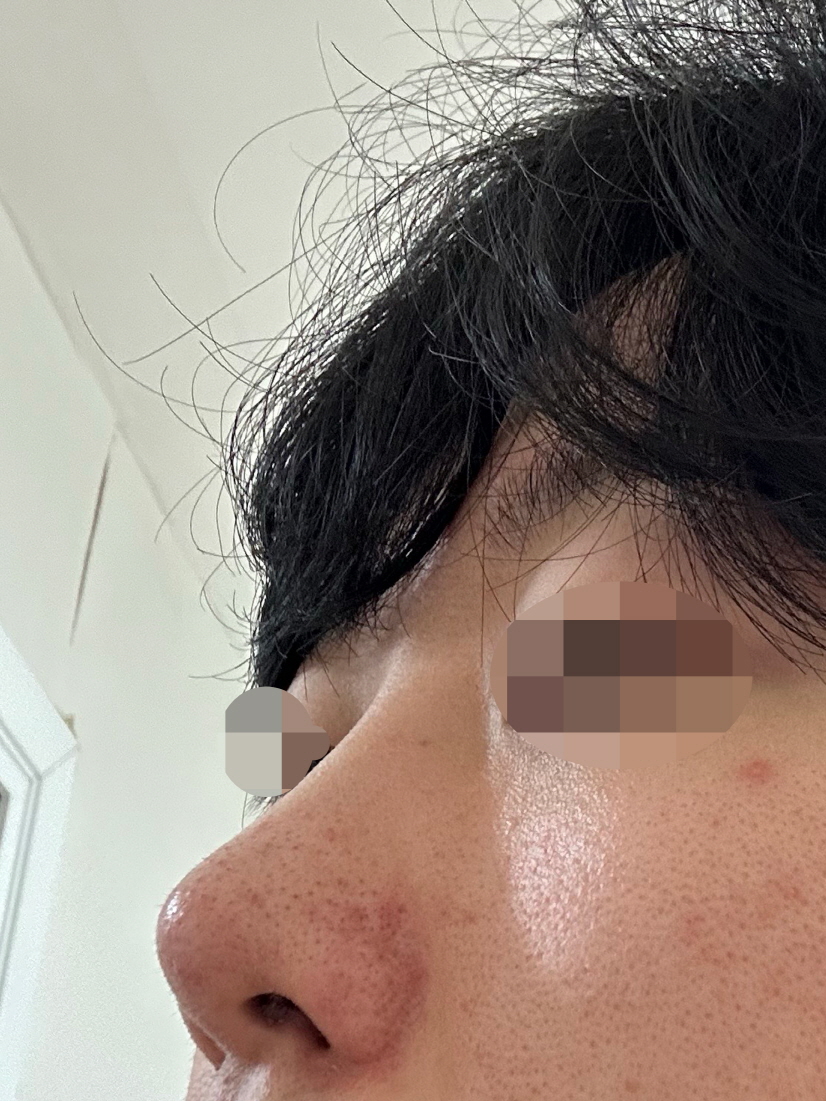 수술후기이미지