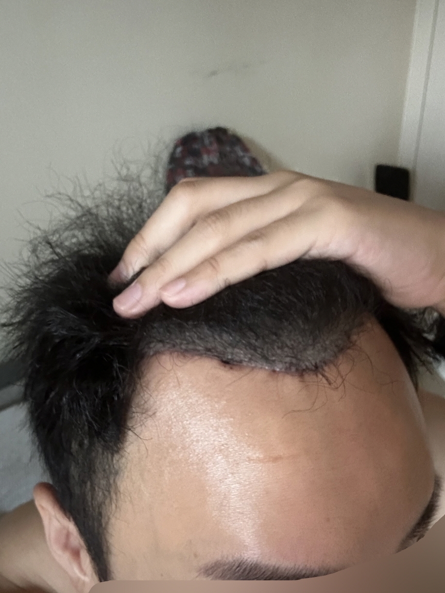 수술후기이미지