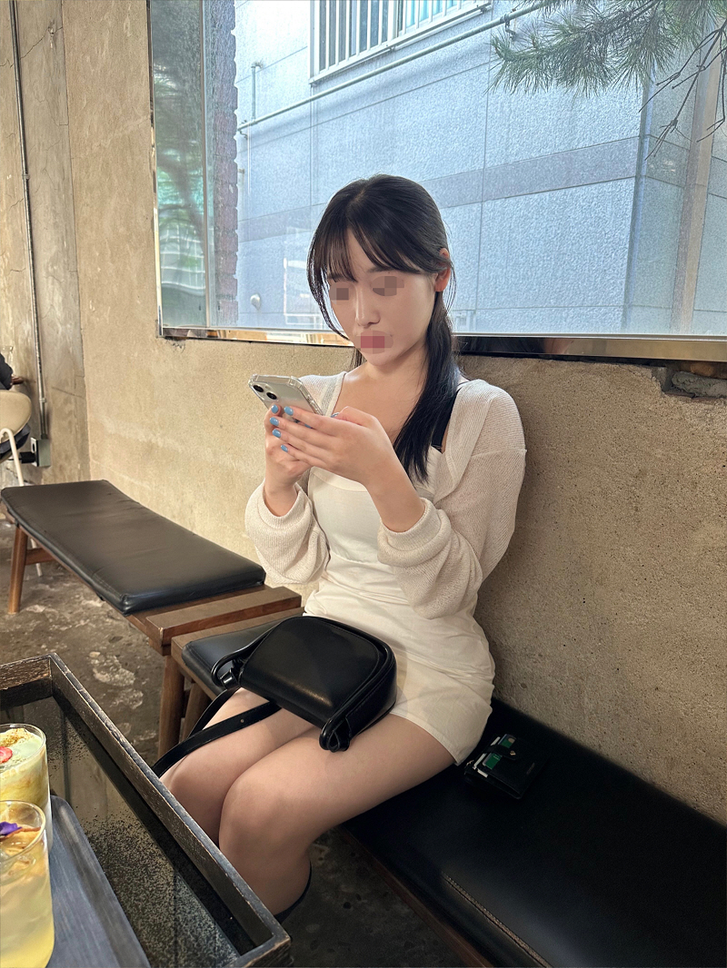 수술후기이미지