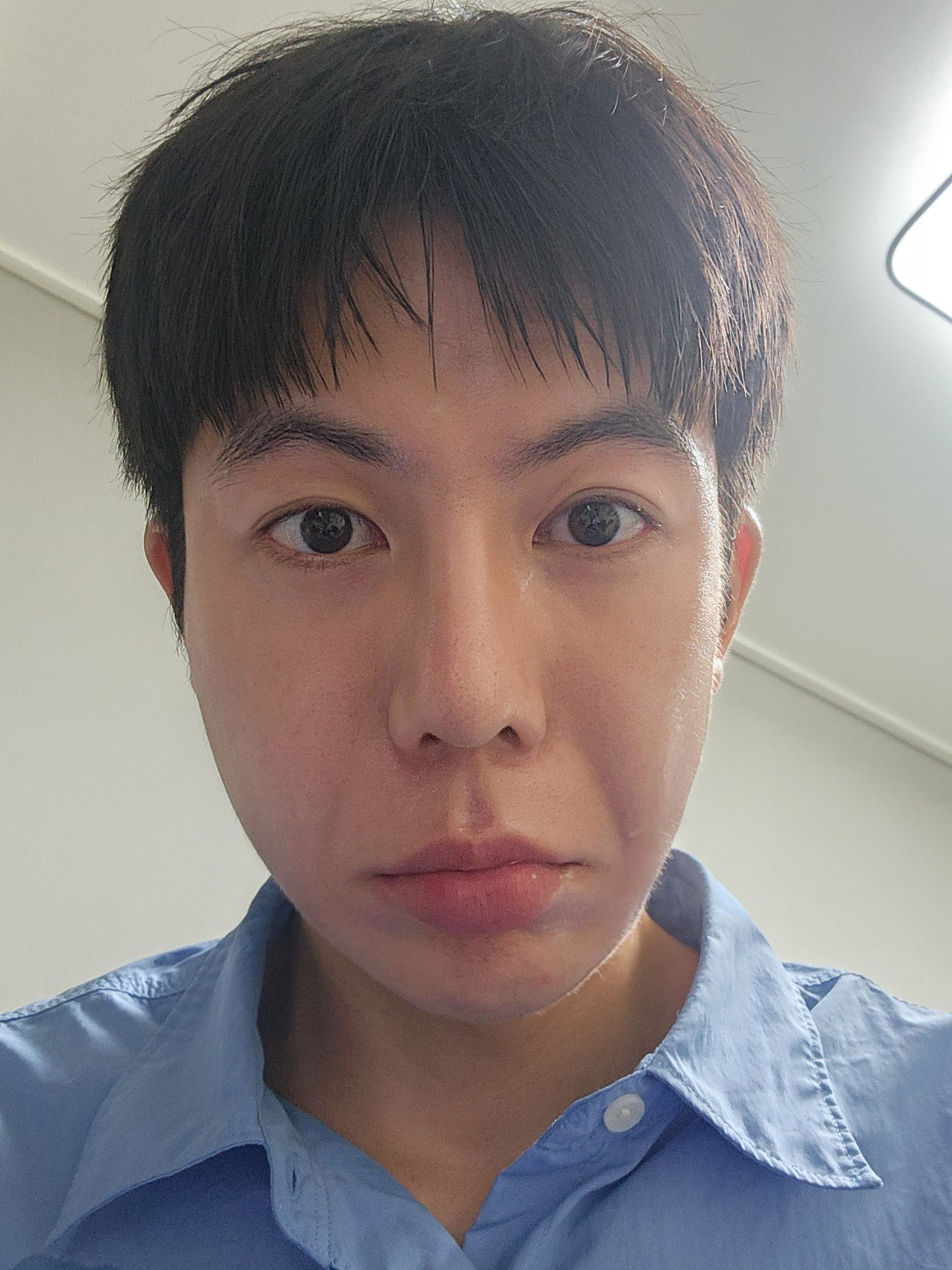 수술후기이미지