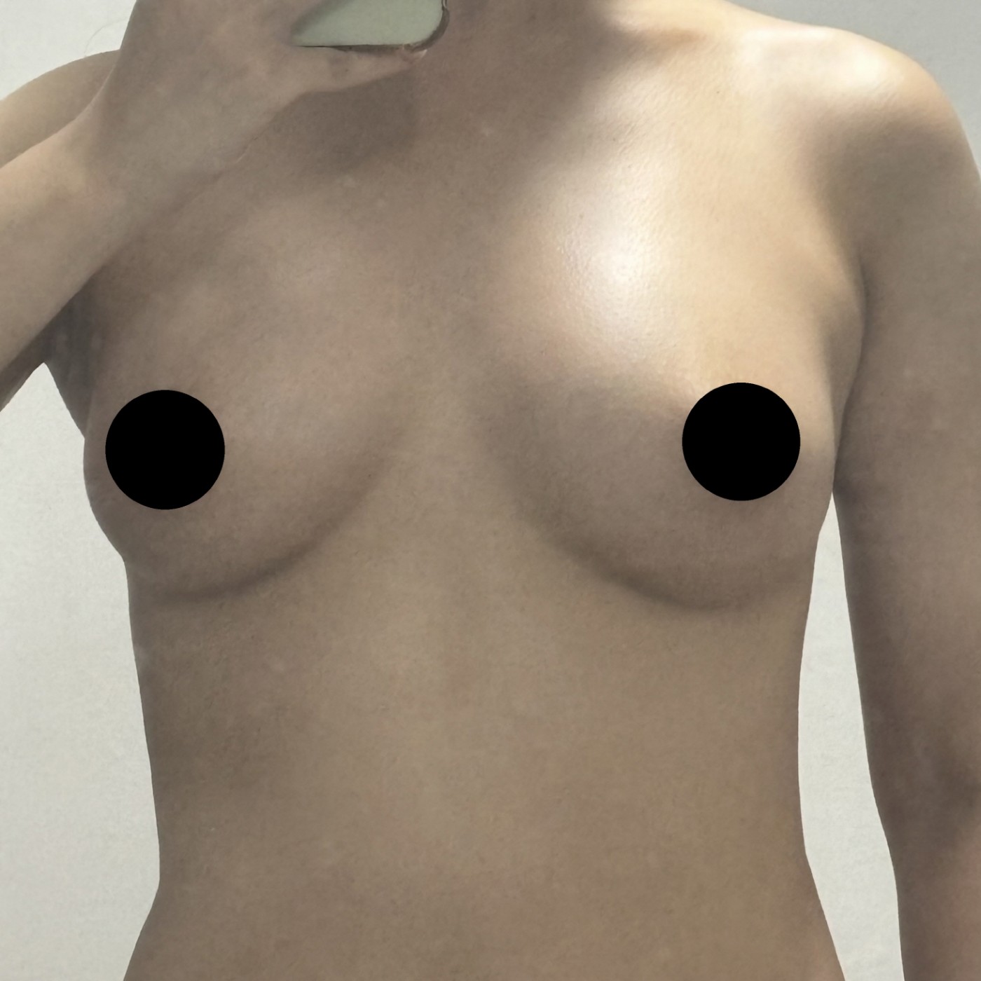 수술후기이미지