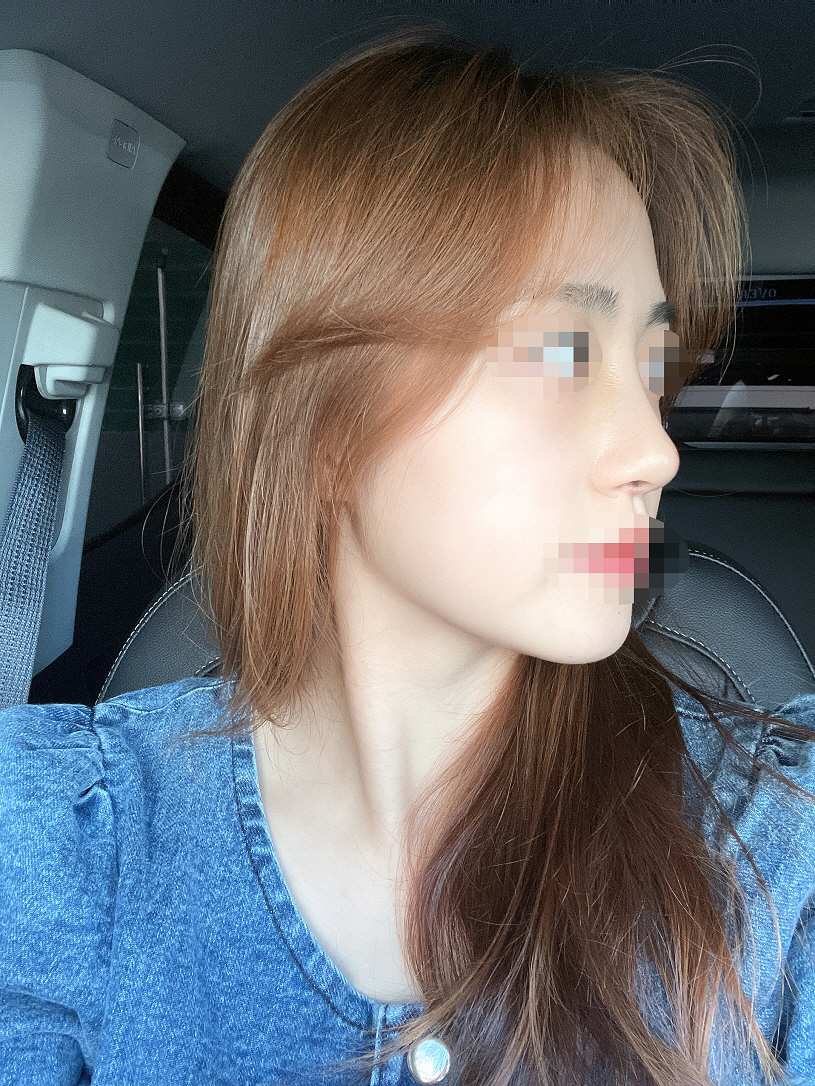 수술후기이미지