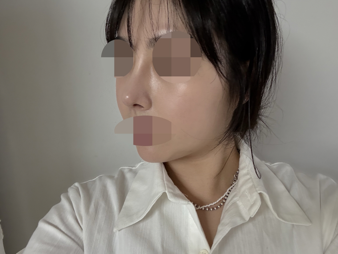 수술후기이미지