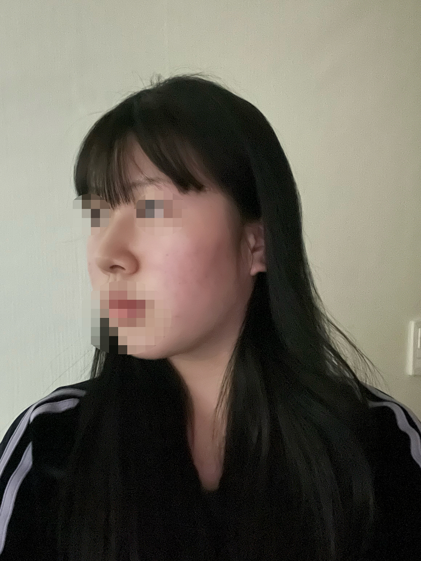 수술후기이미지