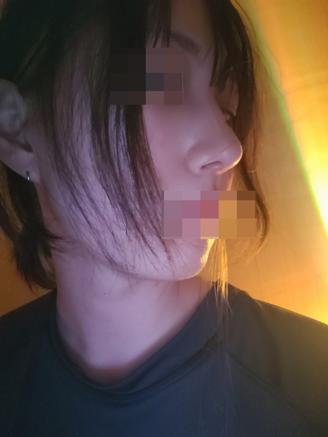 수술후기이미지