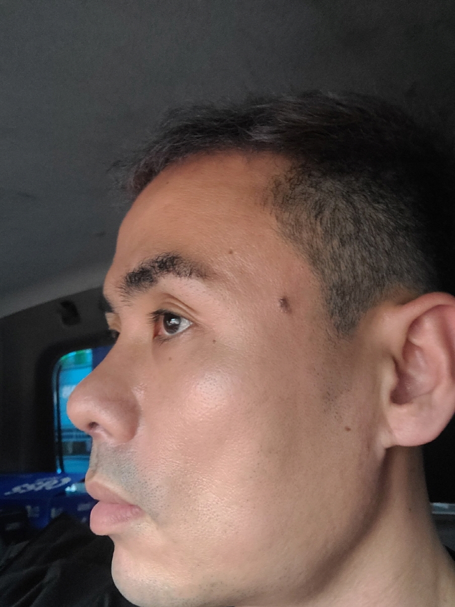 수술후기이미지