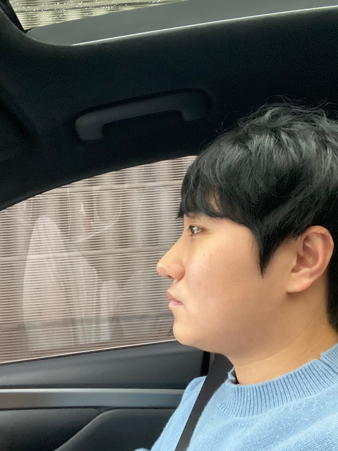 수술후기이미지