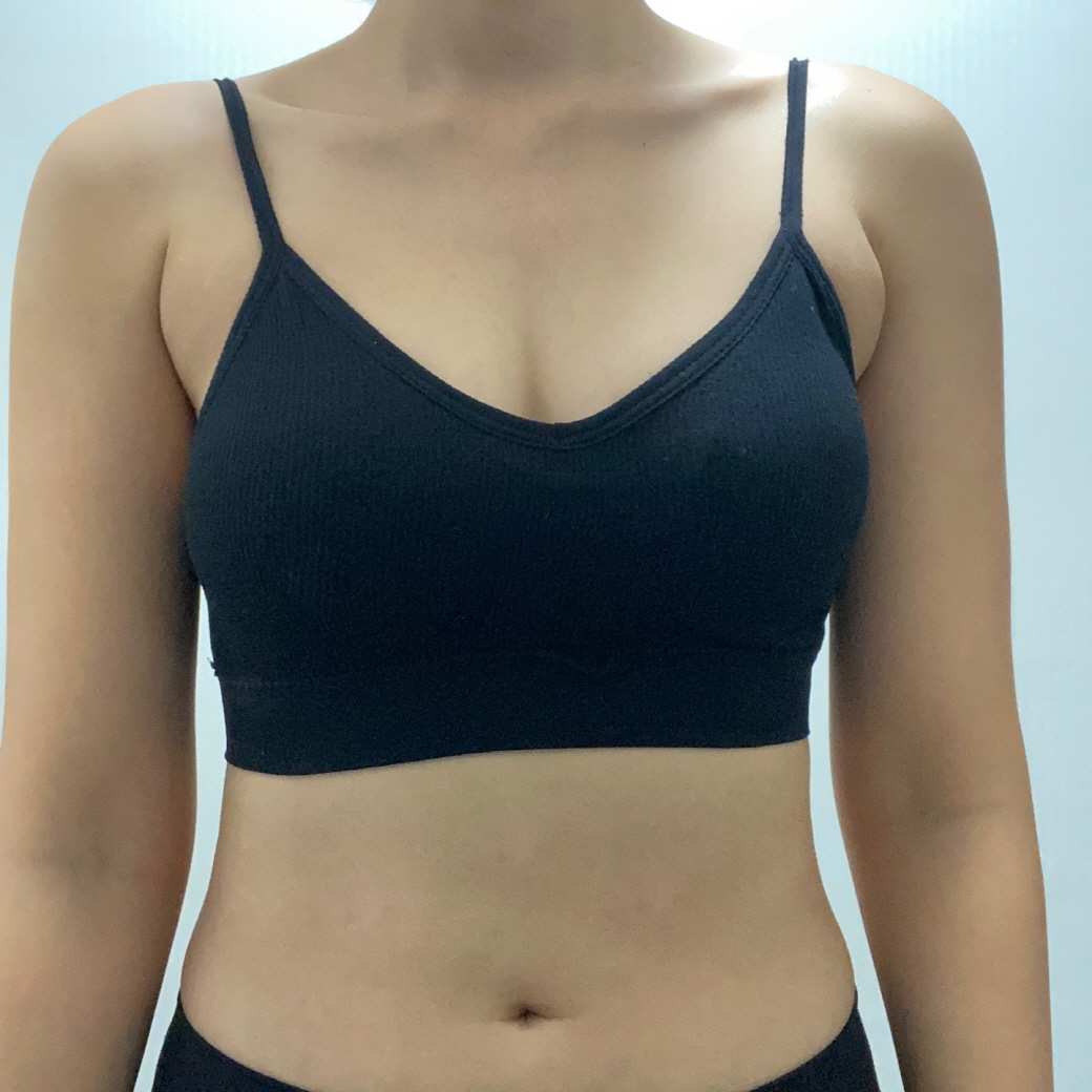 수술후기이미지