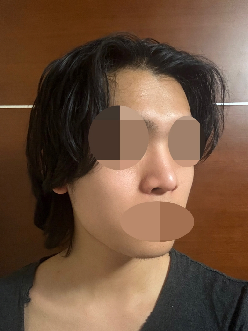 수술후기이미지