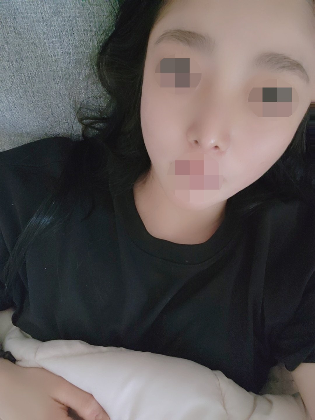 수술후기이미지