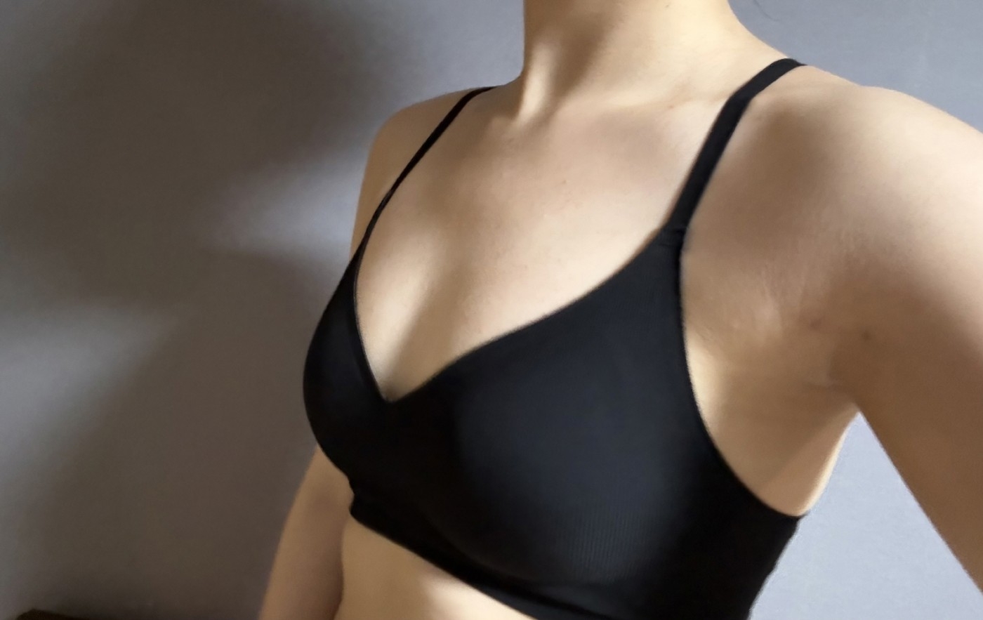 수술후기이미지