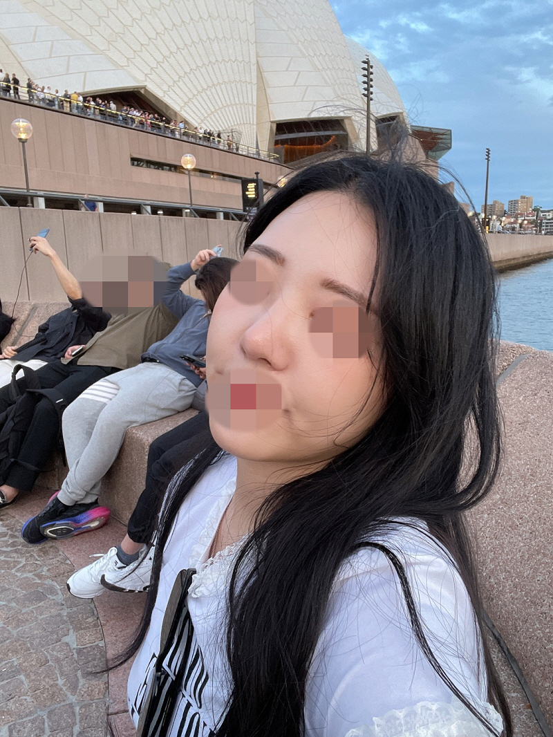 수술후기이미지