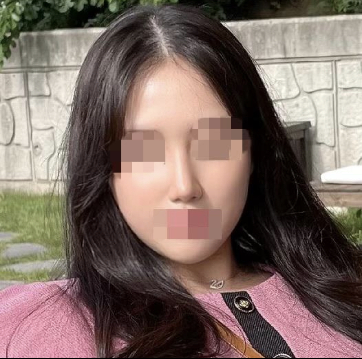 수술후기이미지