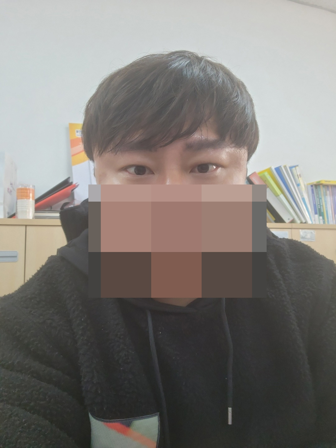 수술후기이미지