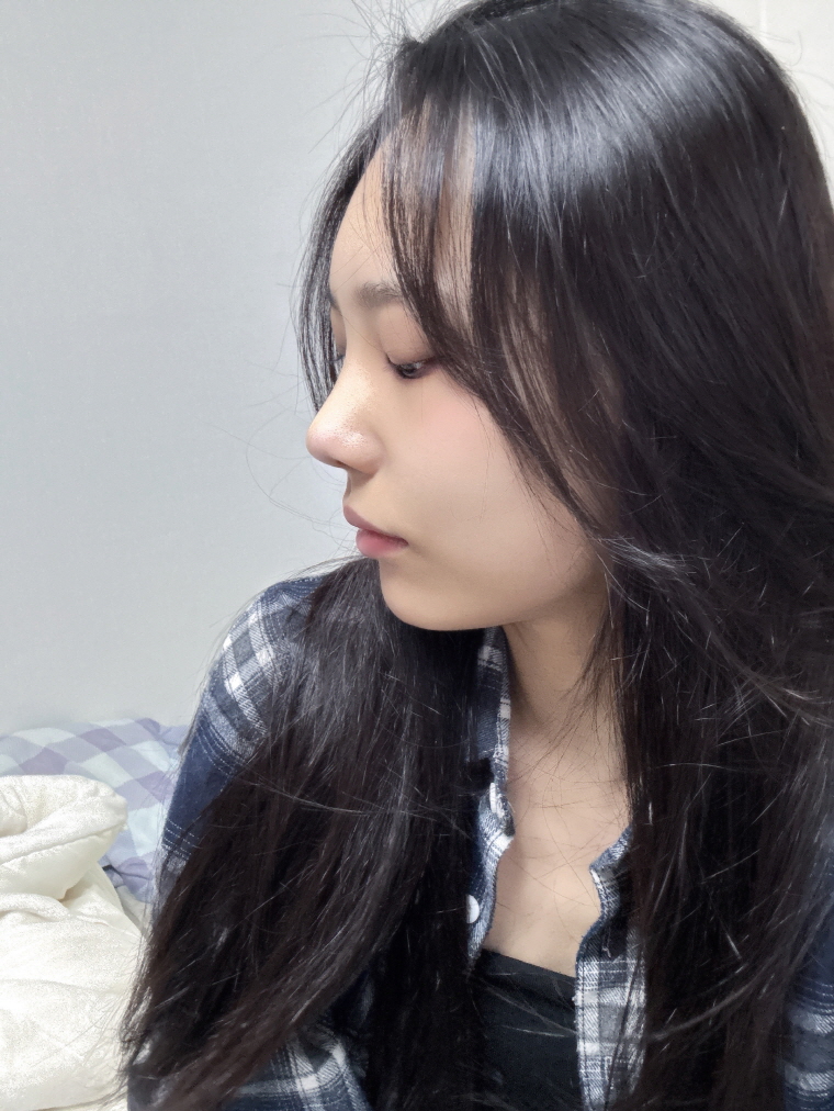 수술후기이미지