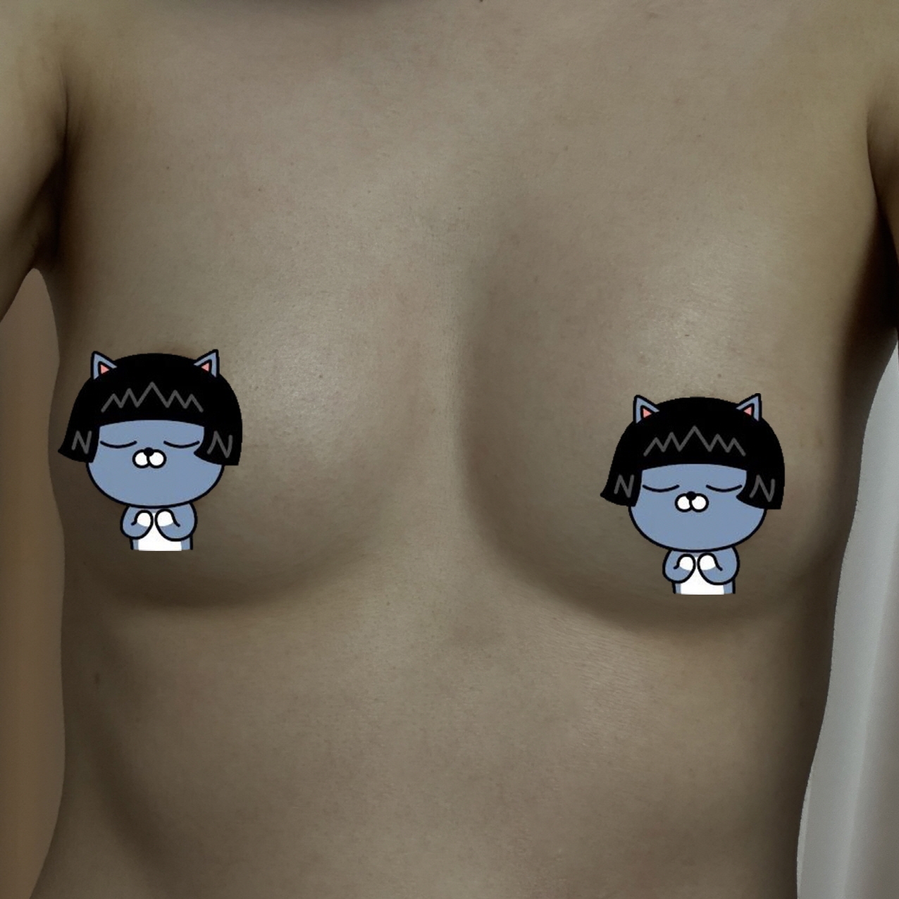 수술후기이미지