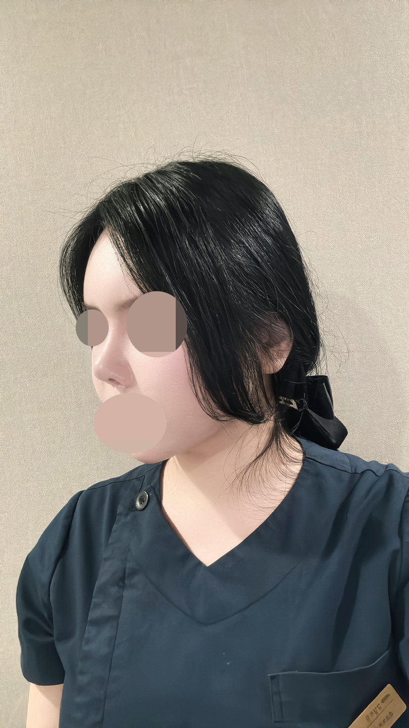 수술후기이미지