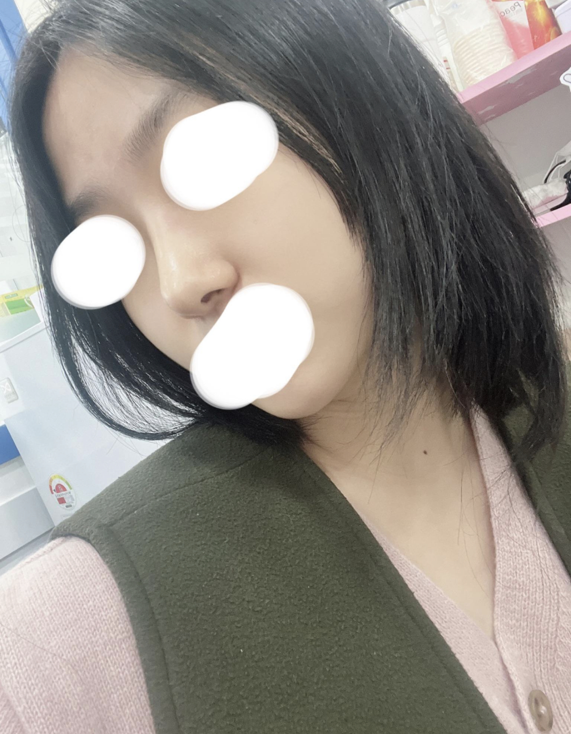 수술후기이미지