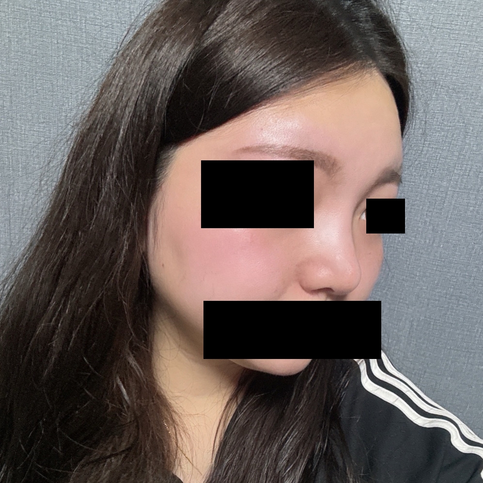 수술후기이미지