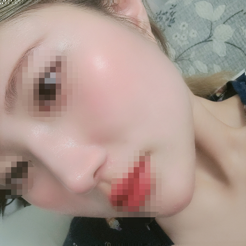 수술후기이미지