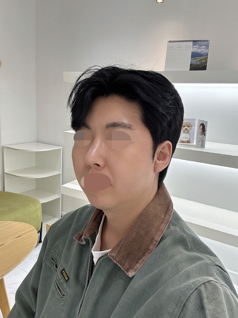 수술후기이미지