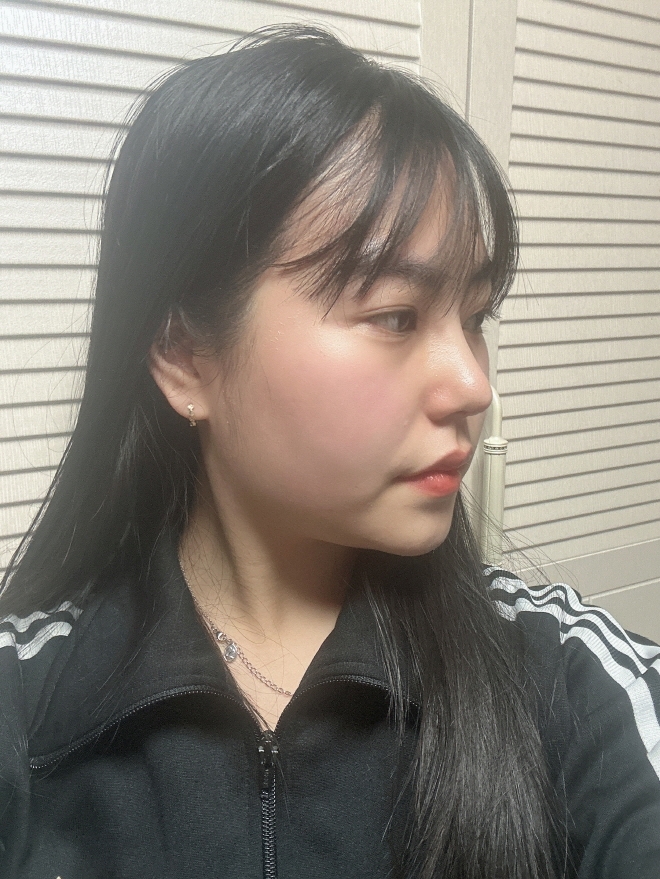 수술후기이미지