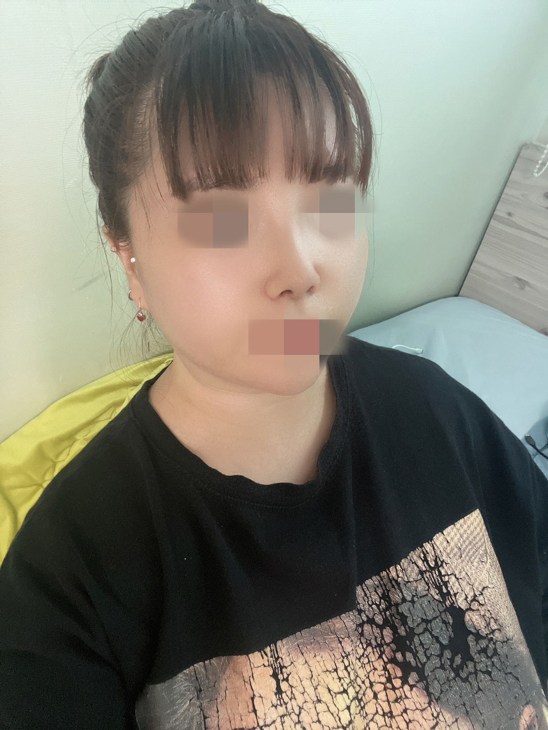 수술후기이미지