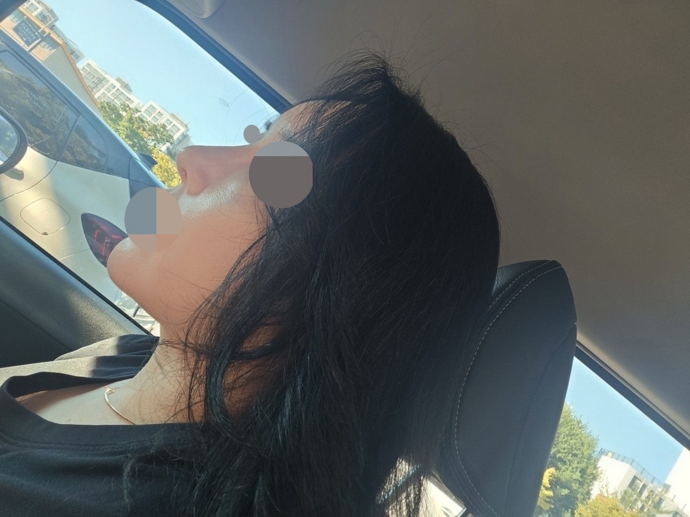 수술후기이미지