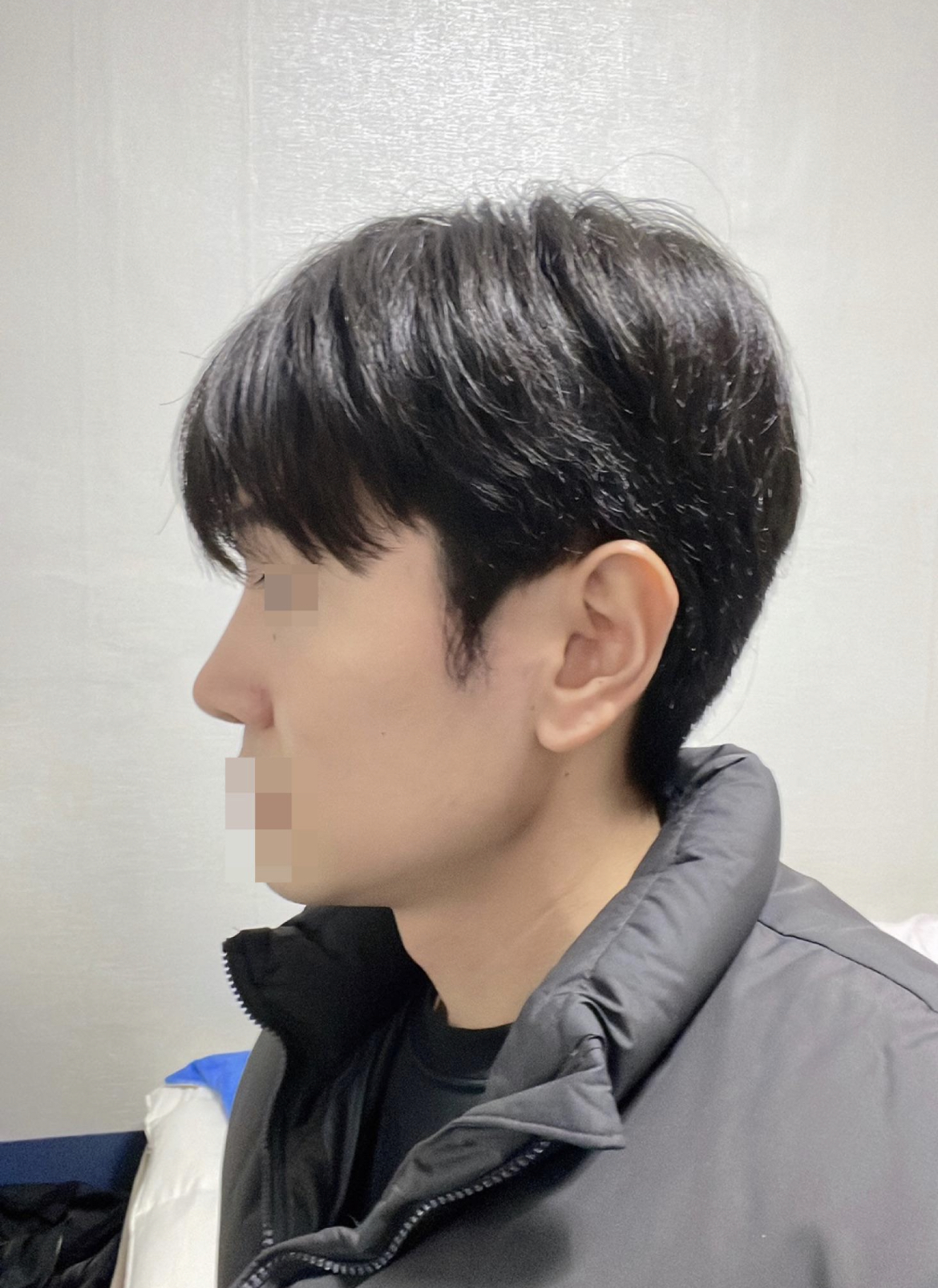 수술후기이미지