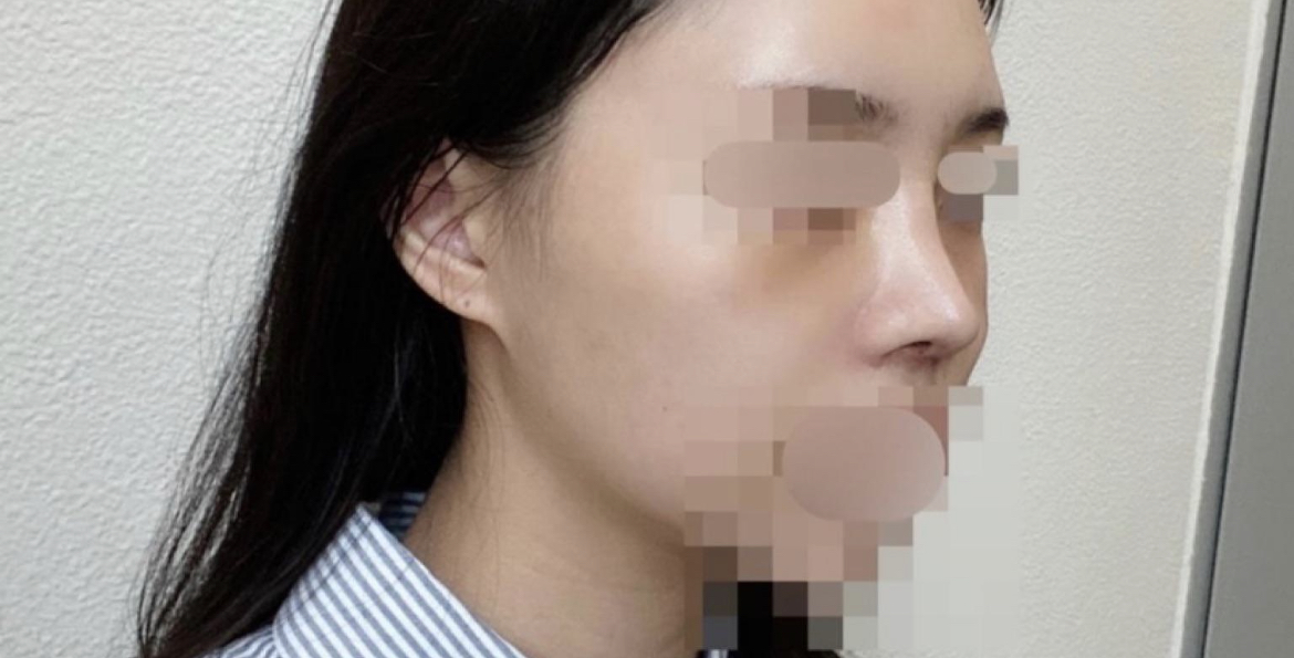 수술후기이미지