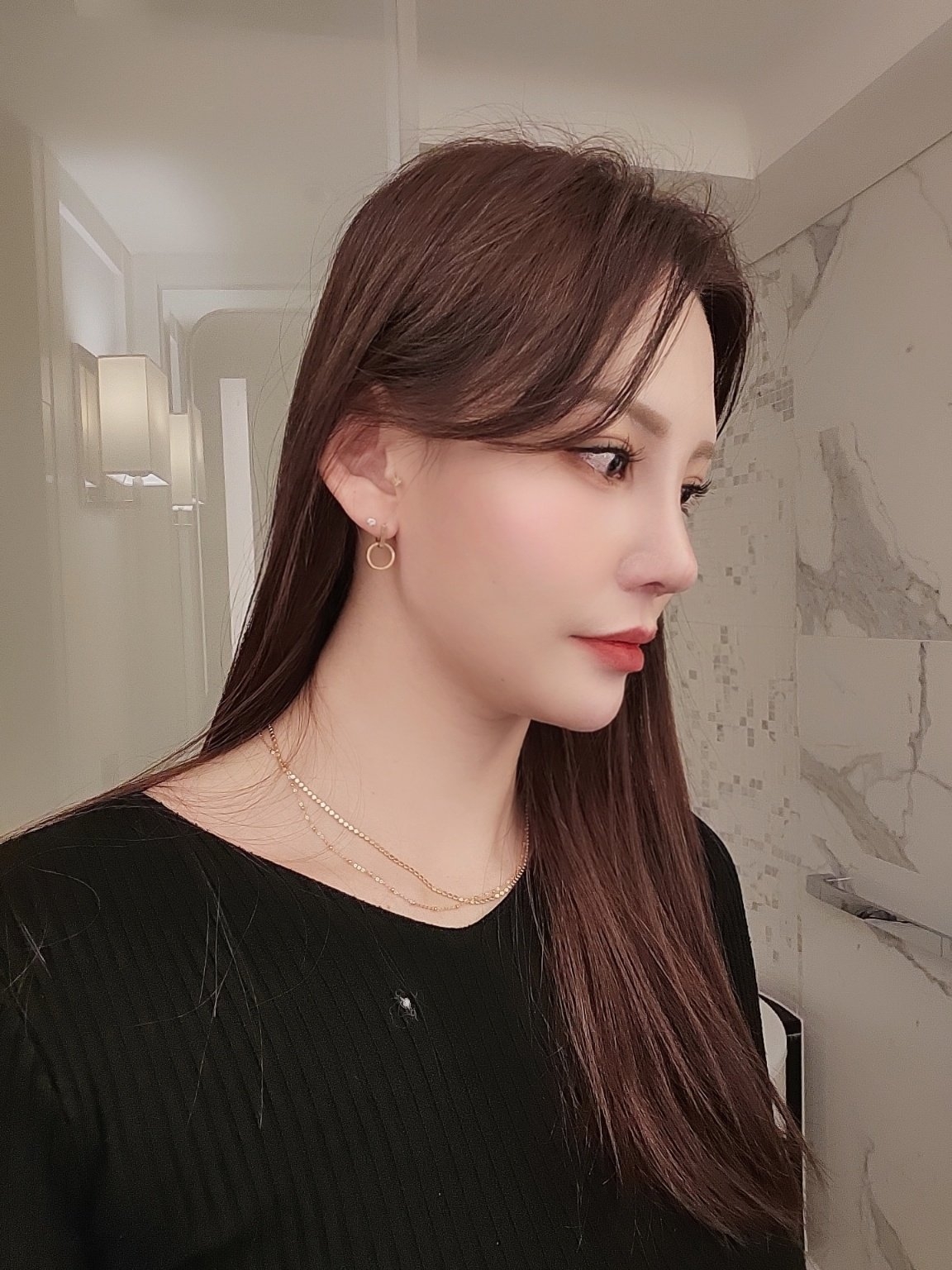 수술후기이미지