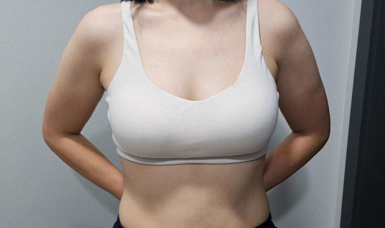 수술후기이미지