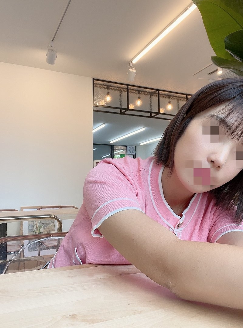 수술후기이미지