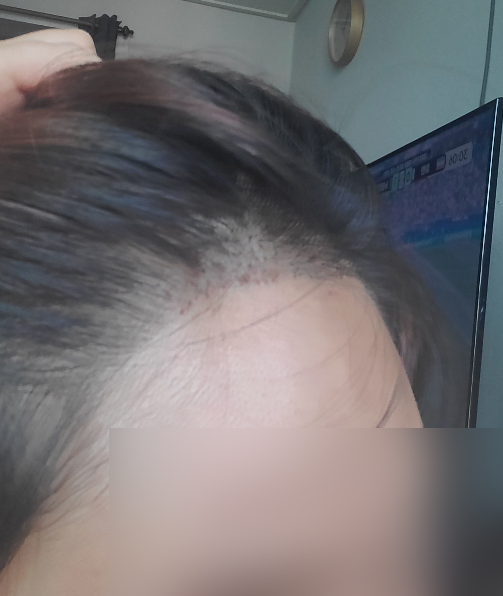 수술후기이미지