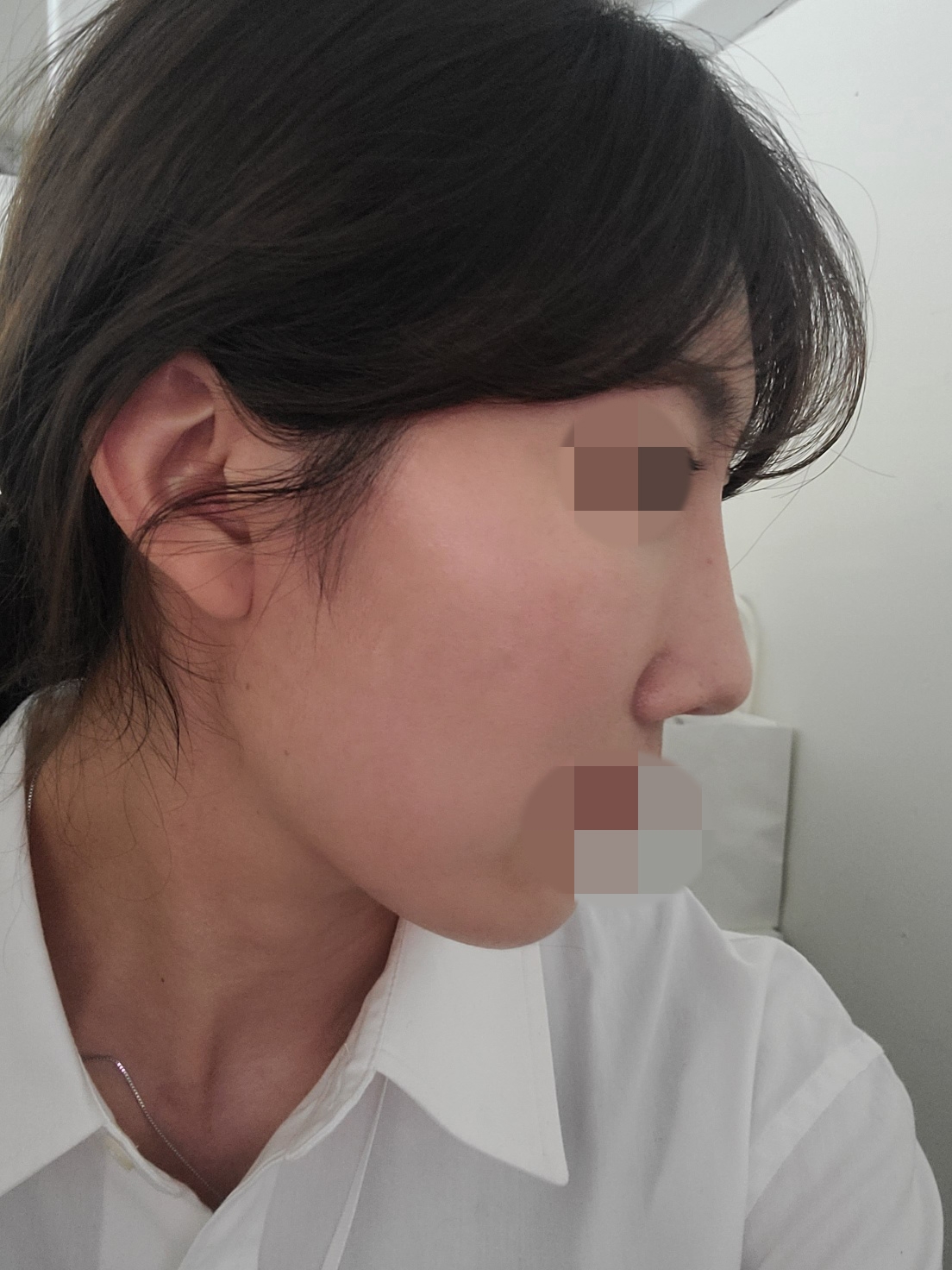 수술후기이미지