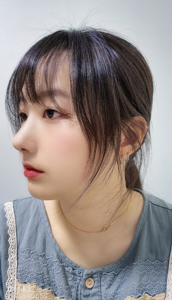 수술후기이미지