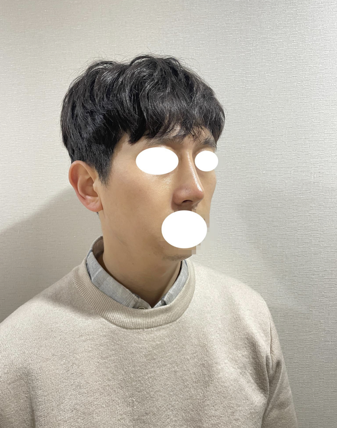 수술후기이미지