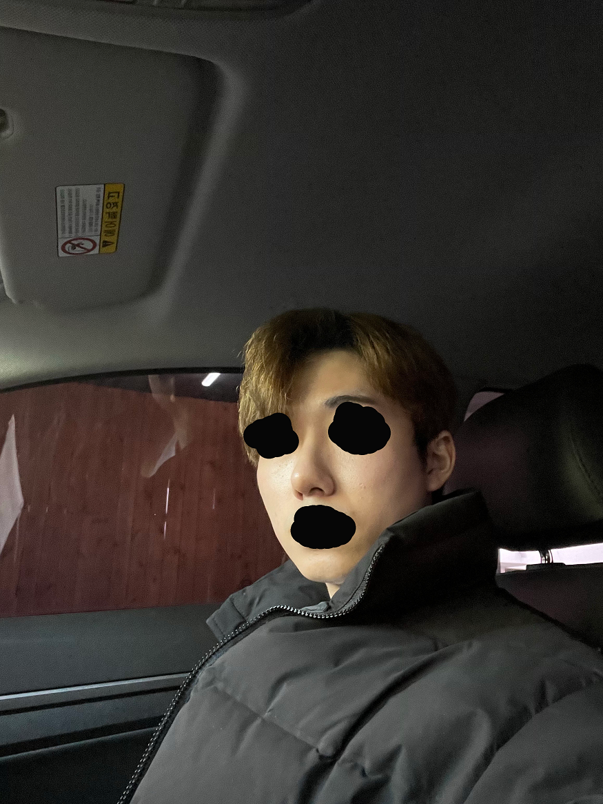 수술후기이미지