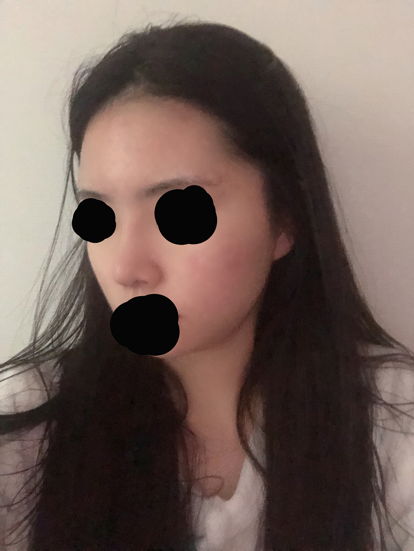 수술후기이미지