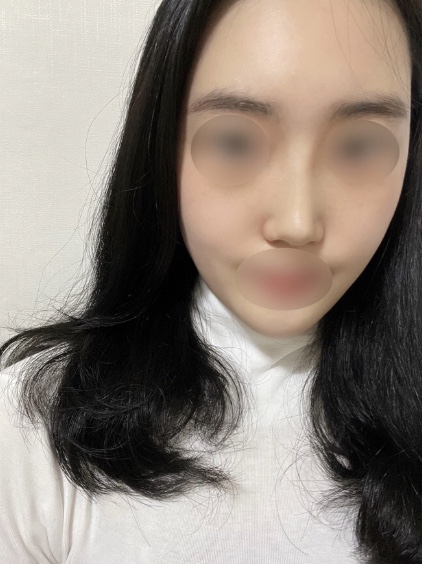 수술후기이미지