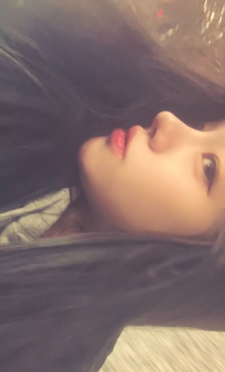 수술후기이미지