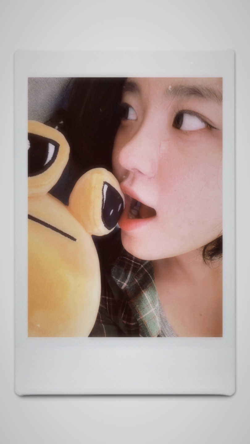 수술후기이미지