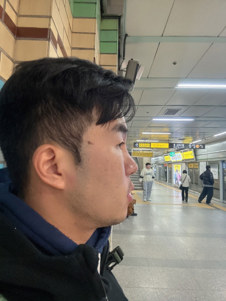 수술후기이미지