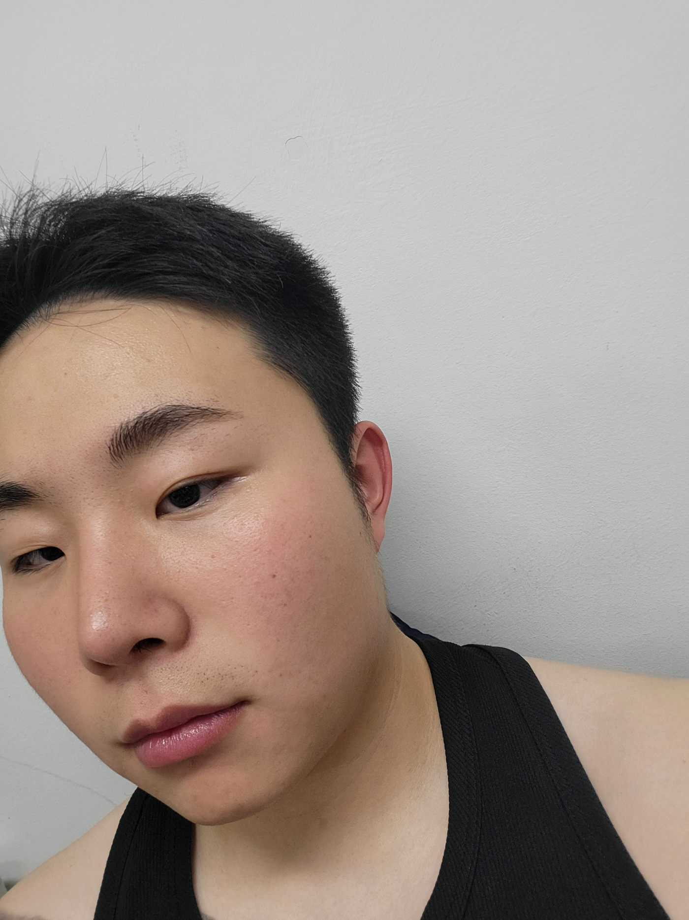 수술후기이미지