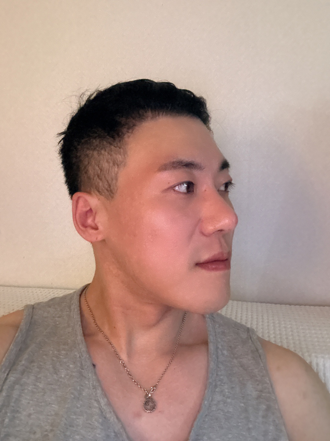 수술후기이미지