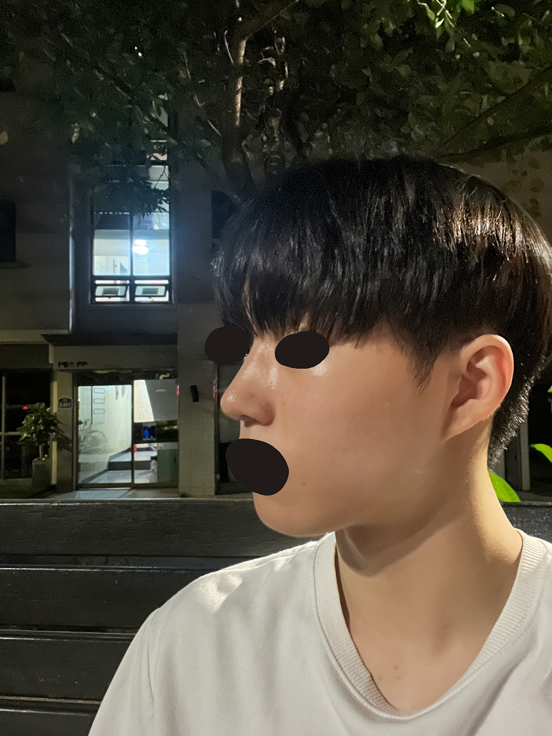 수술후기이미지